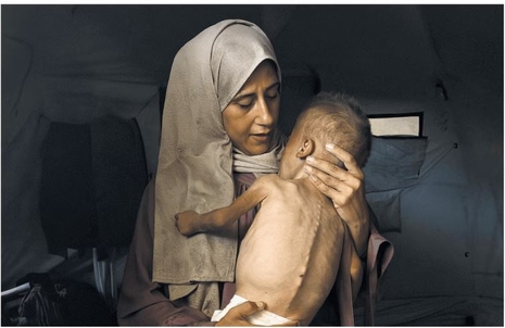 misleading photo of supposedly starving Gaza child NYT 7-25-25