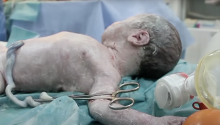 NextImg:EVIL: Gay Men Reportedly Have Their Baby Killed After Surrogate Gets Breast Cancer
