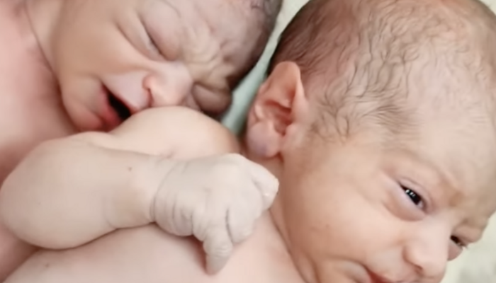 That's Not How It Works: 'Man' Gives Birth To Twins - Vimarsana News