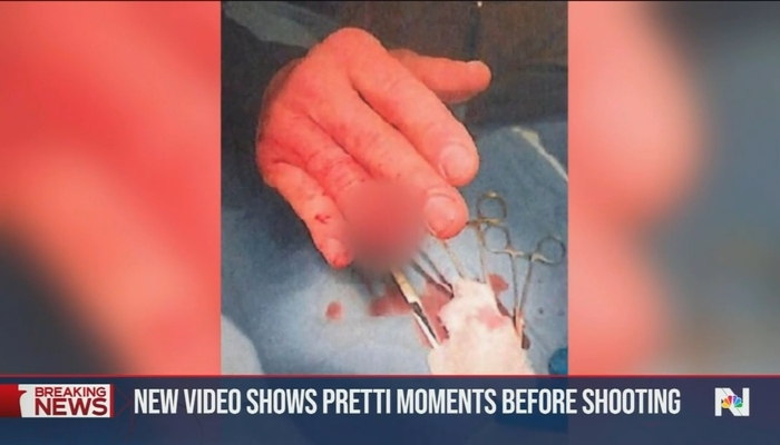 NBC Nightly News are First to Report Violence Against Border Patrol