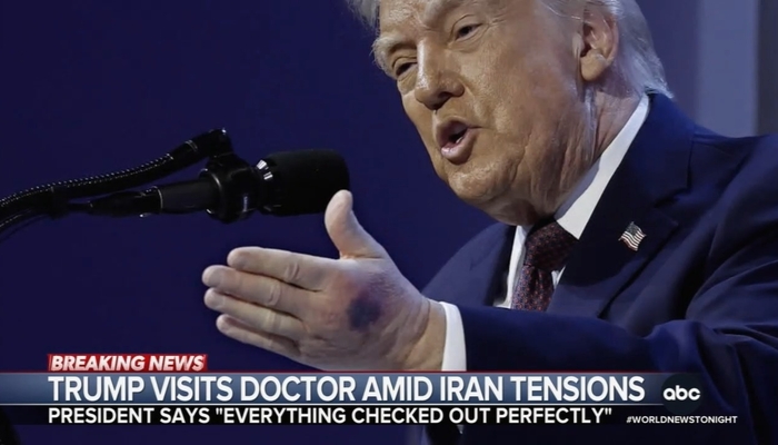 ABC, CBS Show Strange New Concern for Presidential Health