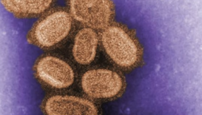 Wikipedia Debates Changing Spanish Flu Name With PC Naming Fight Newsbusters